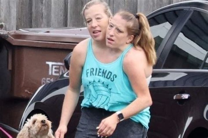 Are Abby And Brittany Hensel Pregnant? Reddit Update On Marriage, Dating Life